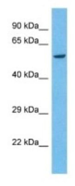 KIR2DS4/CD158i Rabbit anti-Human, Polyclonal, Novus Biologicals:Antibodies:Primary